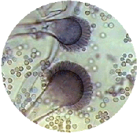 Fungal Spores